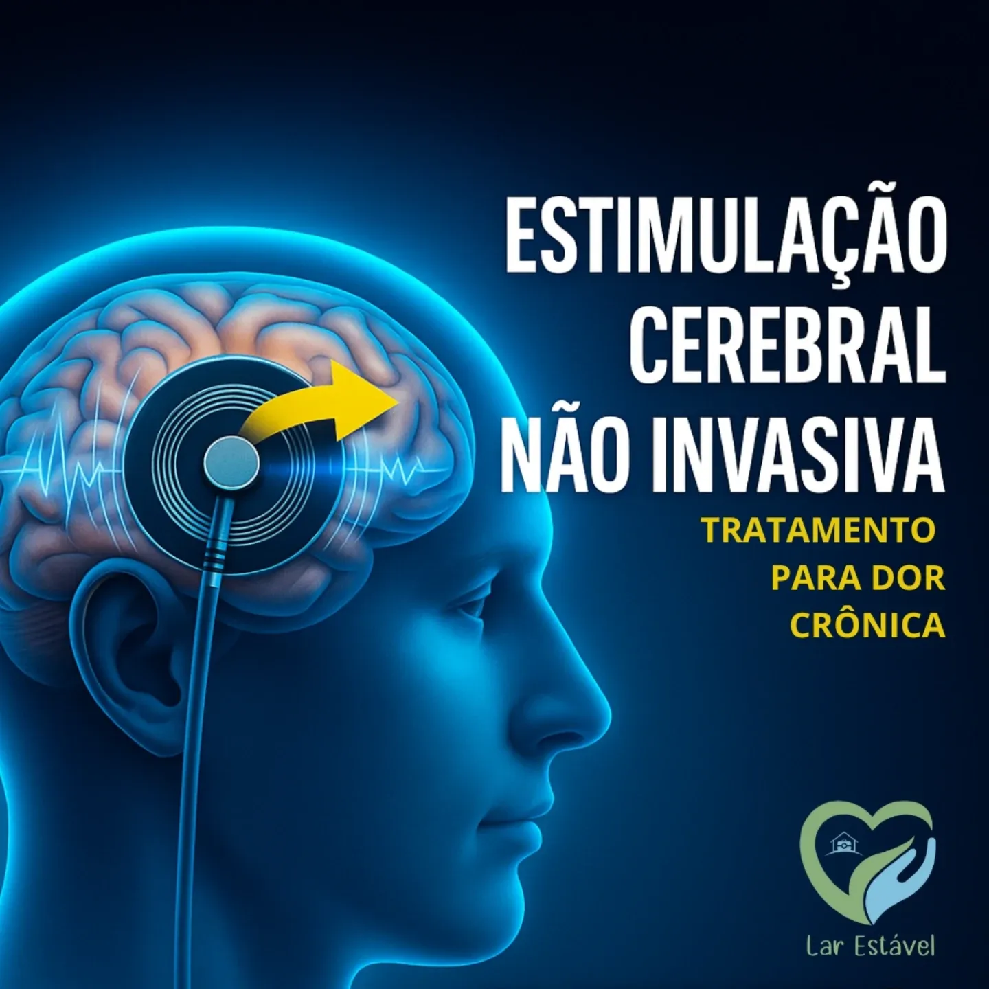 Neuromodulação